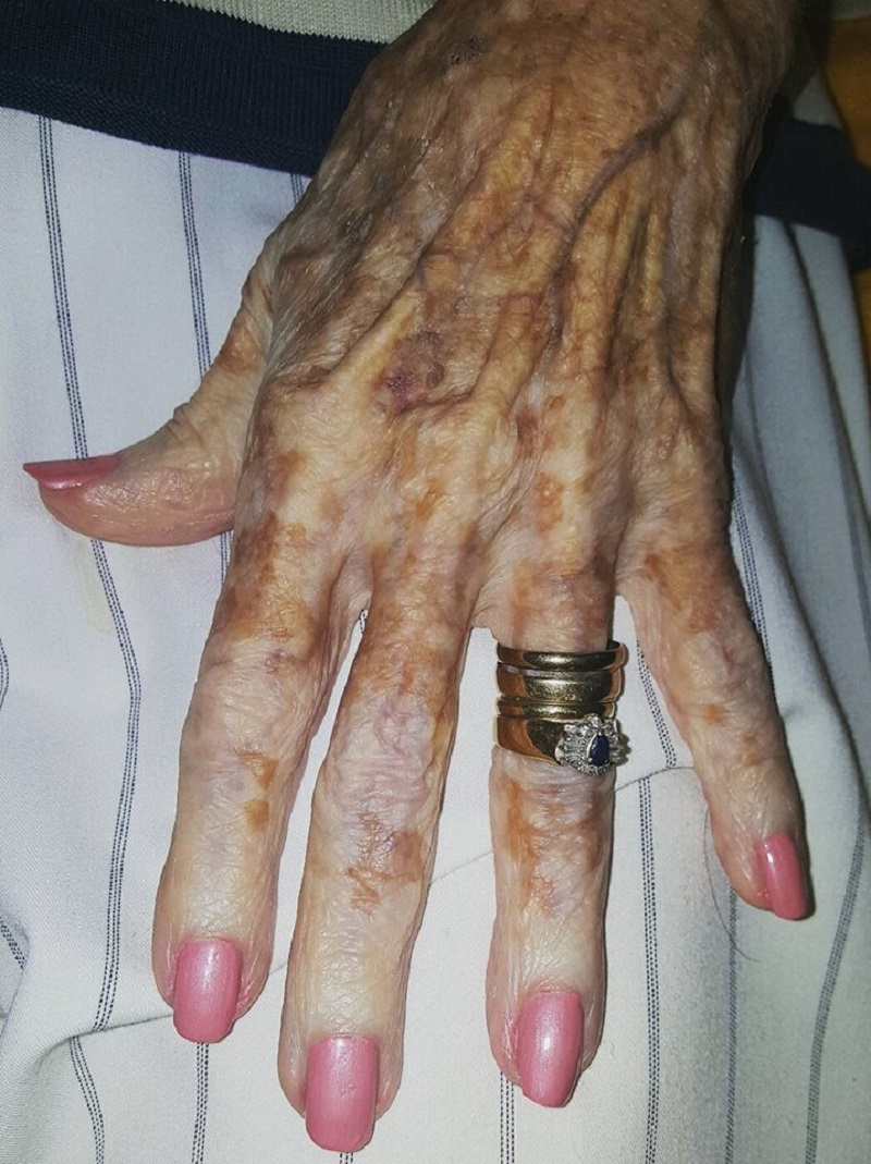 старчески ръце