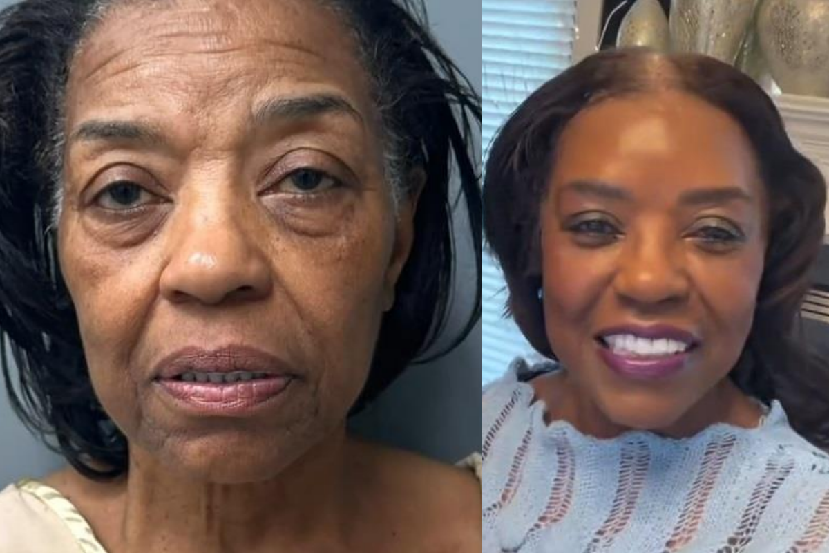 жена пластична операция