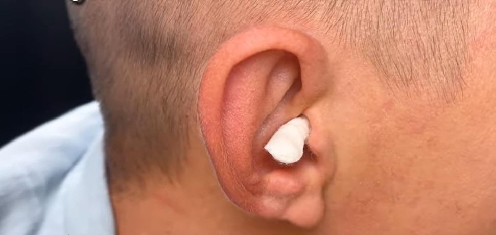 лечение шум в ушите