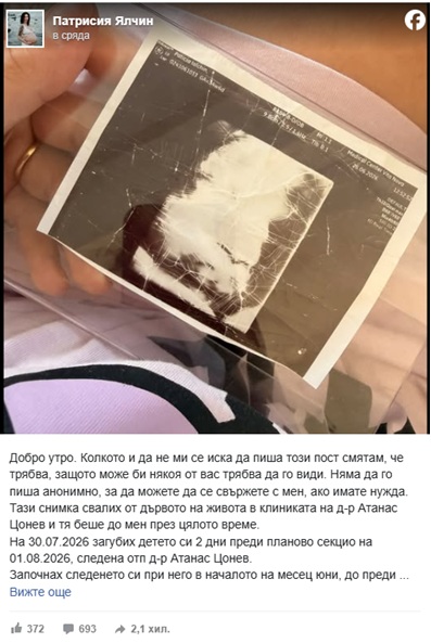 пост родилка