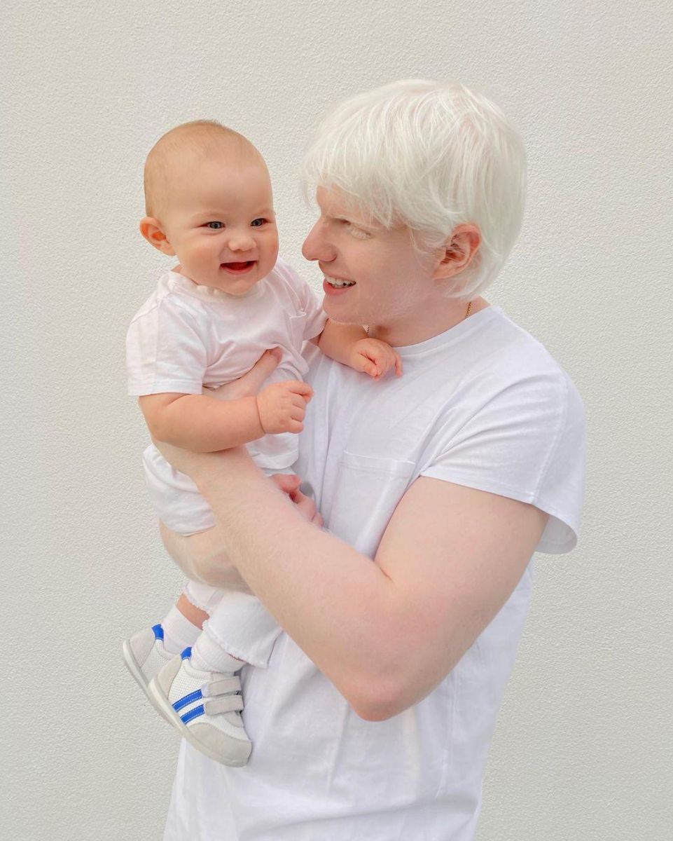 известен албинос със сина си