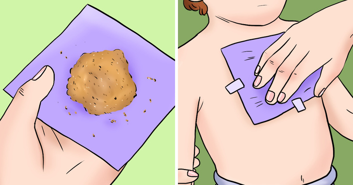  Джинджифилов компрес за кашлица 