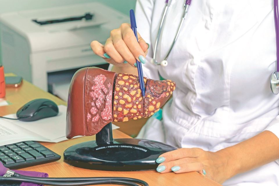 стеатен черен дроб