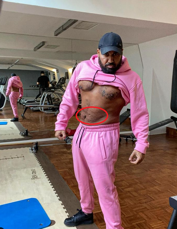  Азис още веднъж се подложи на операция-Ето по какъв начин наподобява след нея-Снимка - За Жената 