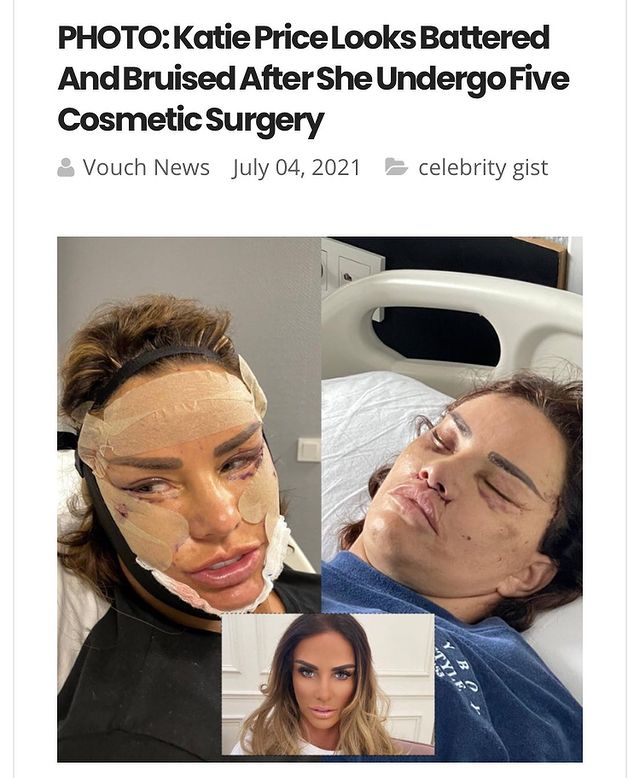 жена след пластична хирургия