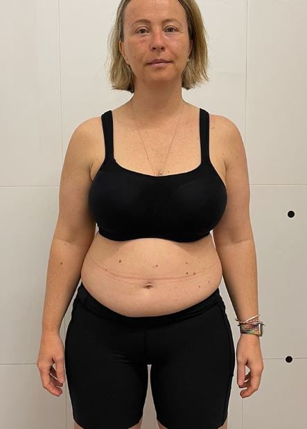 жена наднормено тегло