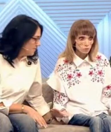 Кристина борба анорексия