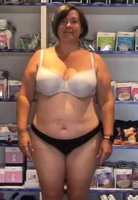 Лиза преди отслабването