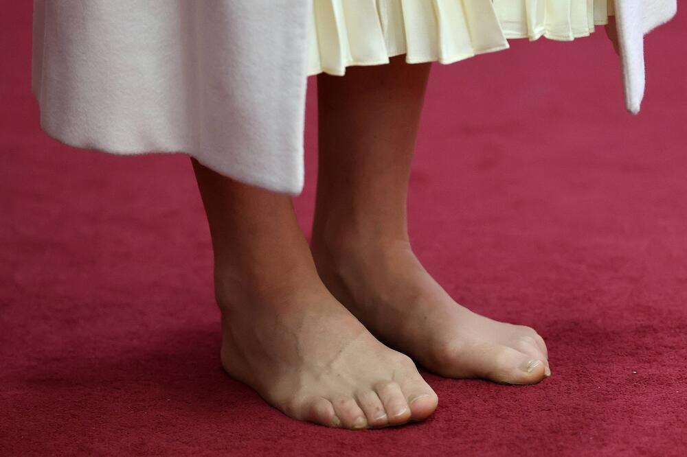 Мидълтън крака