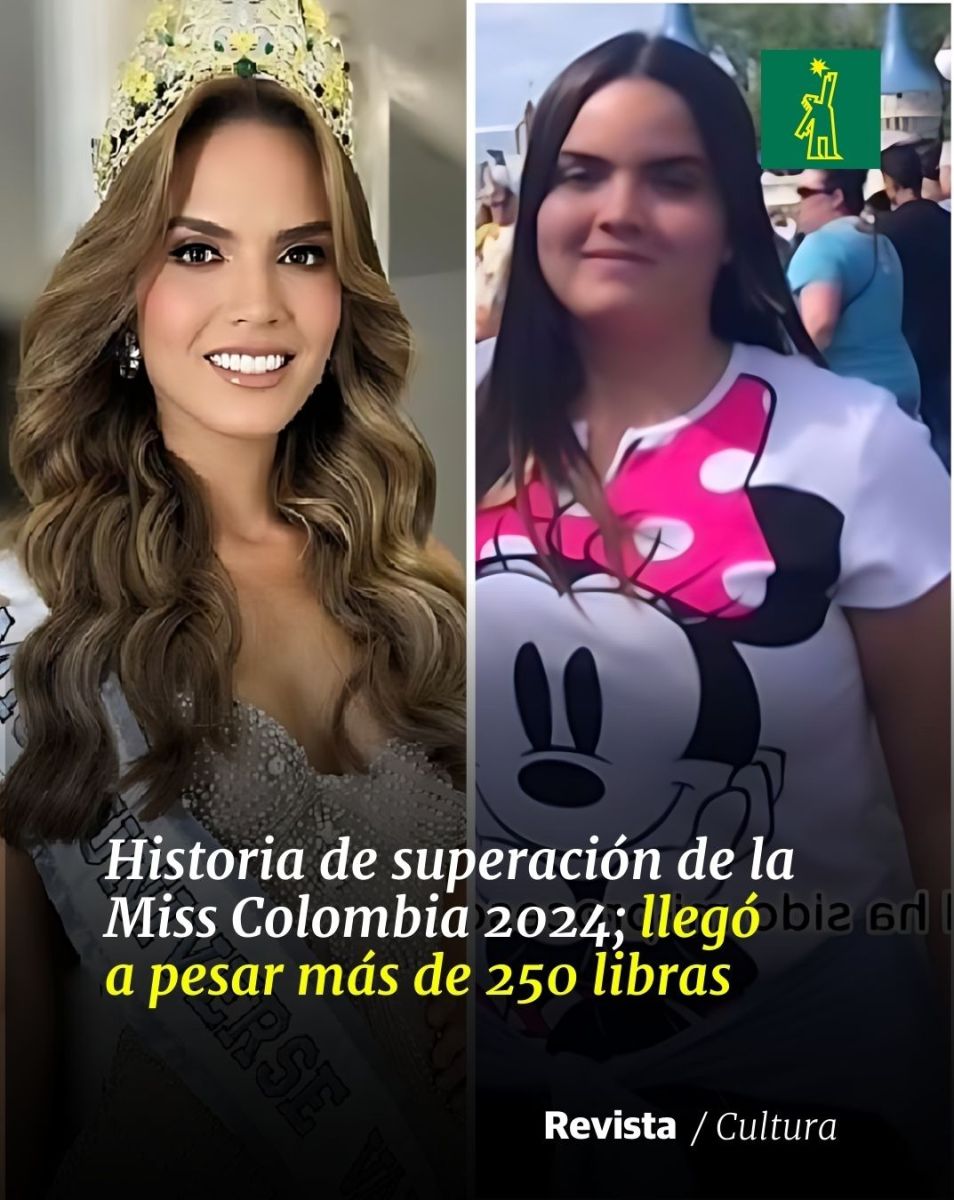 Мис Колумбия преди и след