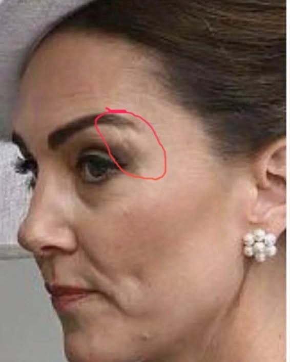 Кейт нов белег