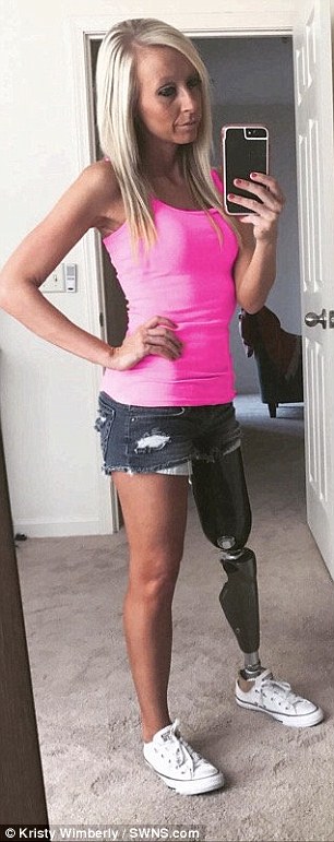 млада жена с протеза