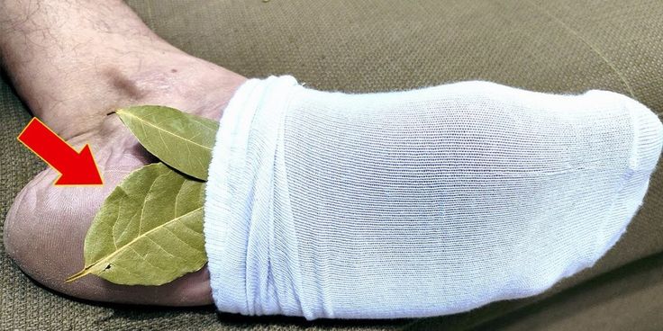 дафинов лист в чорапите метод