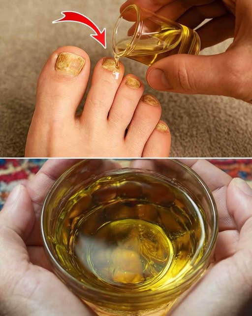 карамфилово масло гъбички