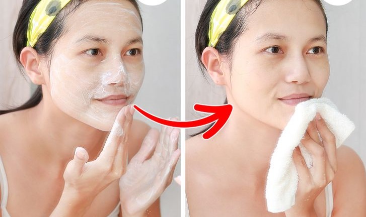  премахване косми по лицето 