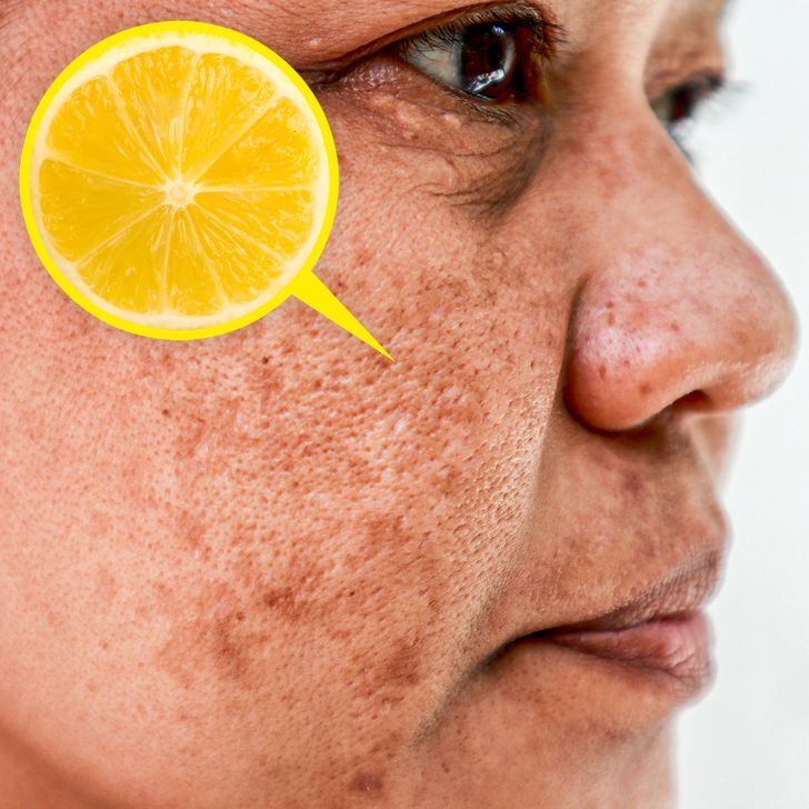 лимон за кожата