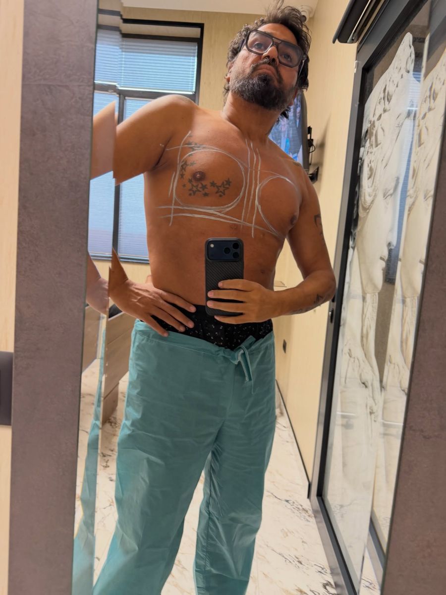 Азис импланти