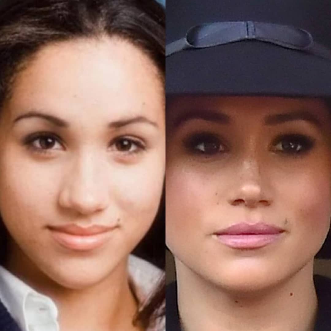 Меган преди и след