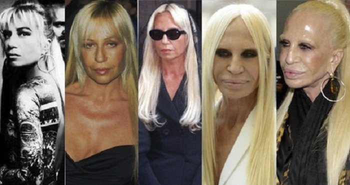  Донатела Версаче интервенции 