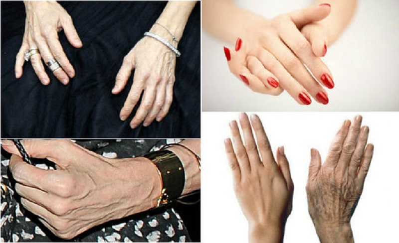 ръце и възраст
