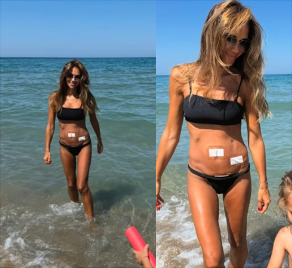 Ивайла Бакалова превръзка