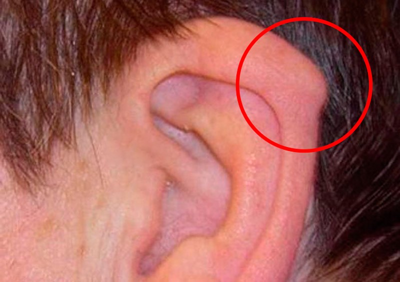 мускул ухо