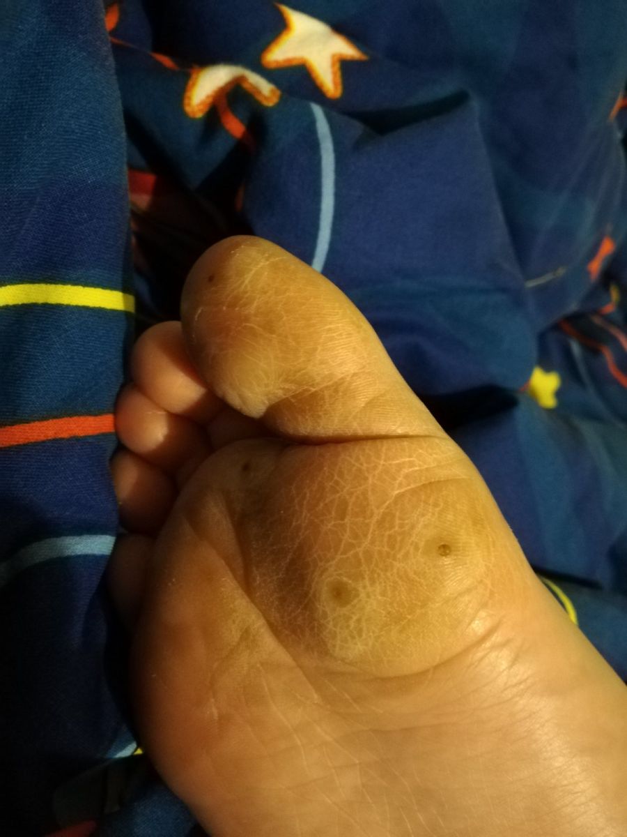 кокоши трън