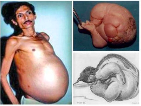 бременен индиец