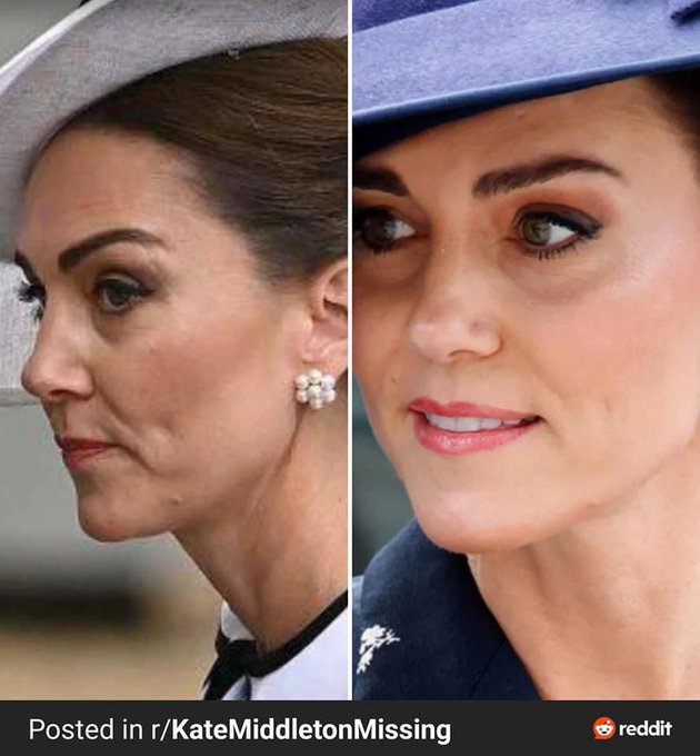 Кейт мистериозен белег