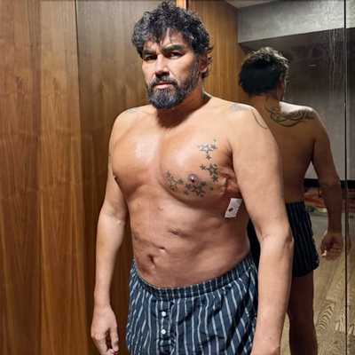 Азис импланти гърди