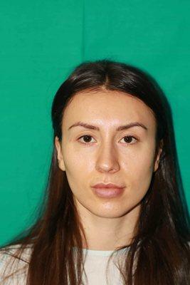 Китана преди операциите