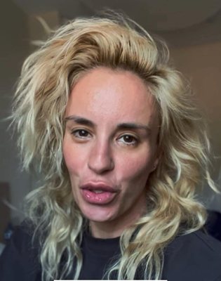 Кърджилова нови устни