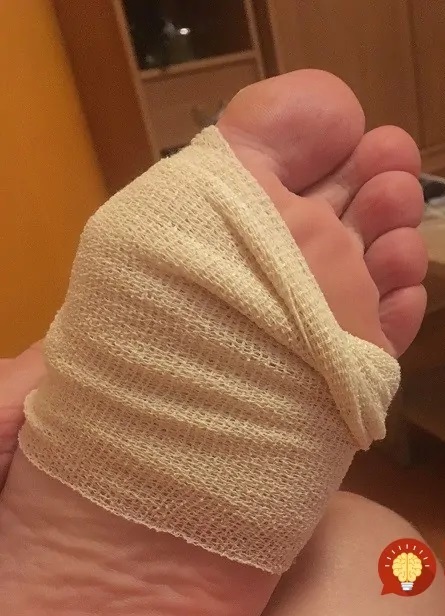 бинтован крак