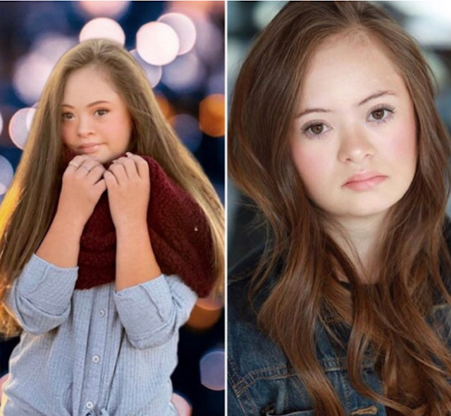  красиво момиче Даун 