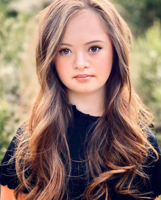  хубавица със синдром на Даун 