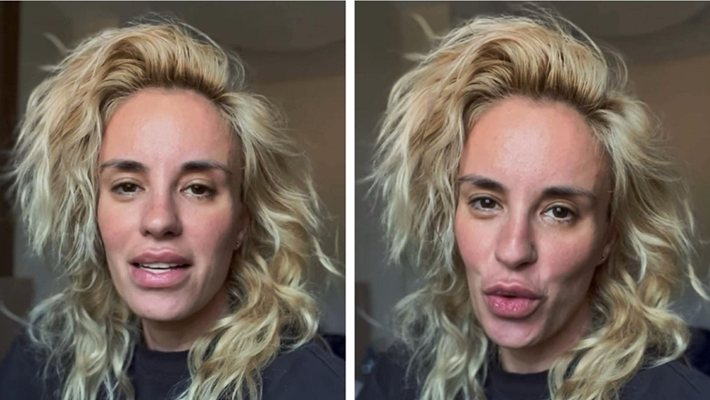 Радина устни