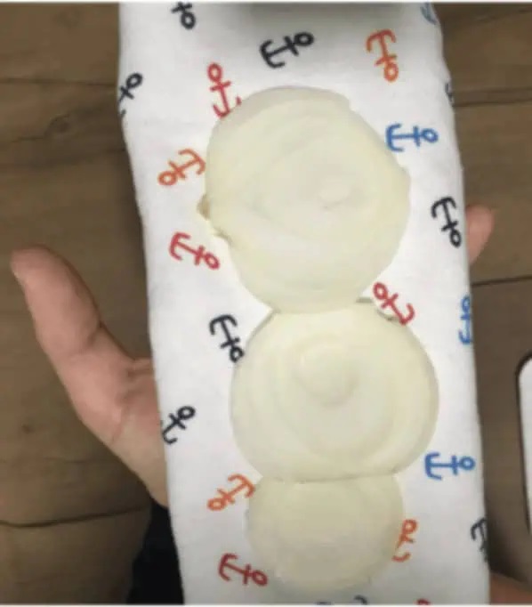 компрес с лук