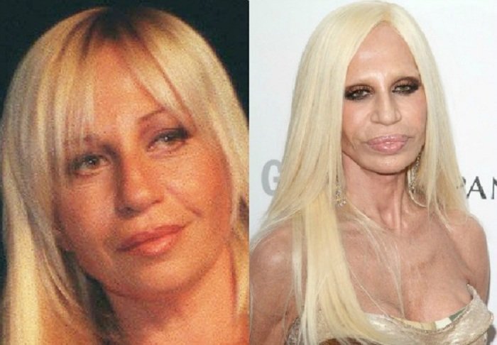  Донатела Версаче интервенции 