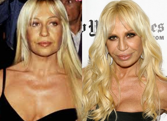  Донатела Версаче преди и в този момент 