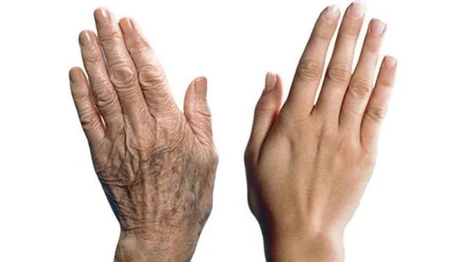 ръце и възраст