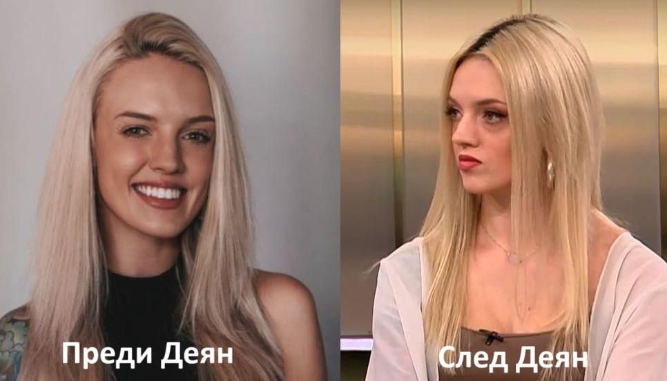Анна Кошко преди и след