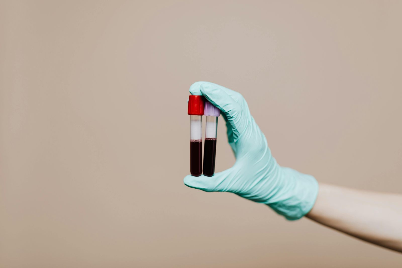 blood sample