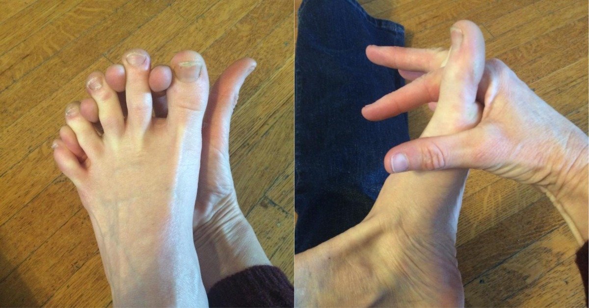 масаж на пръстите на краката