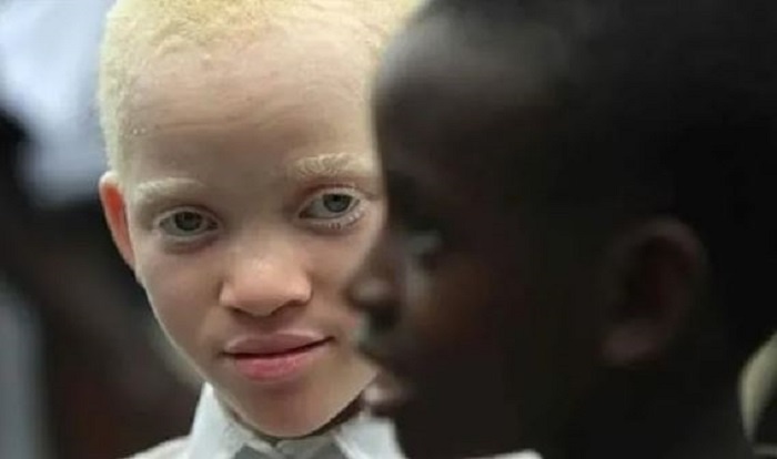 бяло нигерийско дете