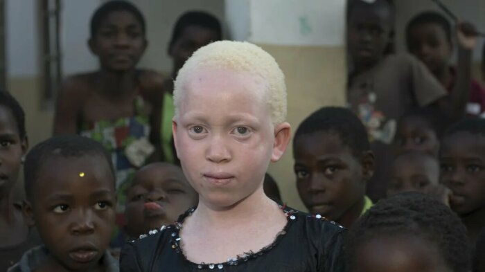 нигерийско момиче бяла кожа