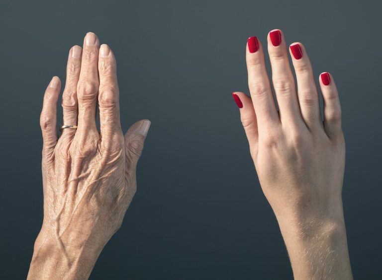 ръце възрастна жена маникюр