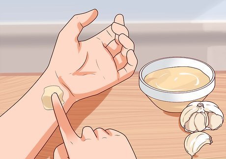 чесън за брадавици