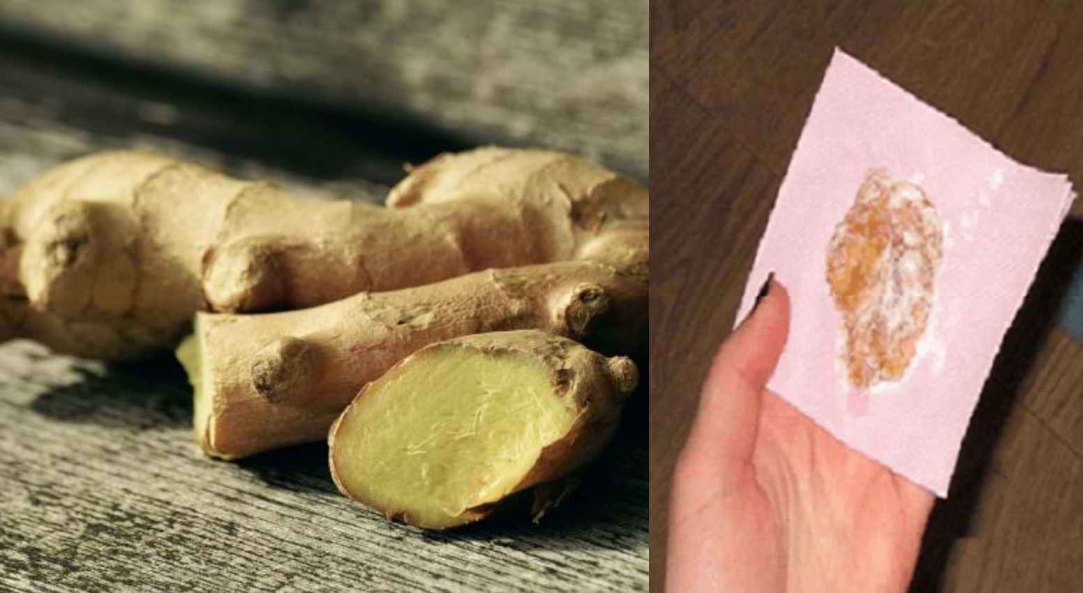 джинджифилов компрес