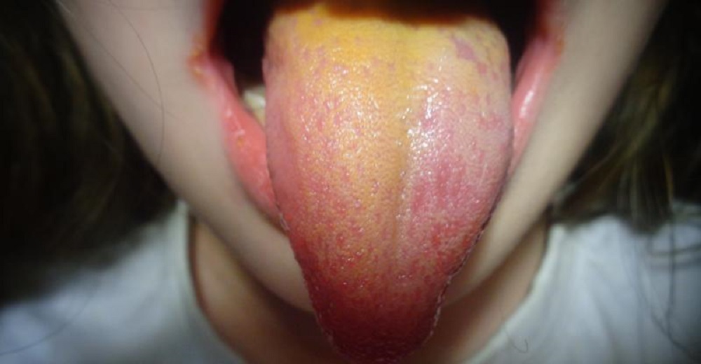 жълт език